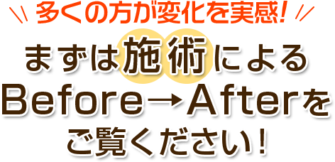 まずは施術によるビフォーアフターをご覧ください!